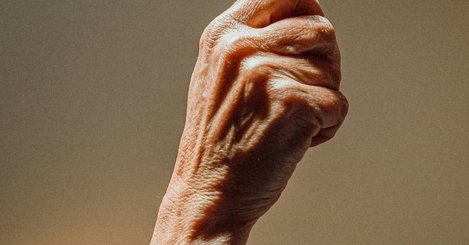 Arthritis image